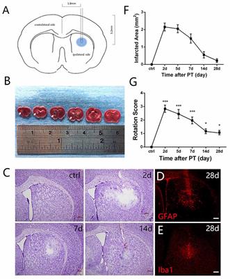 Expression of DCX and Transcription Factor Profiling in Photothrombosis-Induced Focal Ischemia in Mice